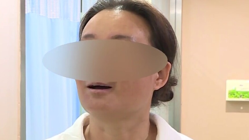 女子熬夜饮食不规律 脸上竟长出“白斑”：40岁女士昼夜颠倒患“白癜风” 白斑散布影响正常生活